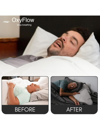 Tiras Nasales OxyFlow Modelo Y - 30 Unidades para Alivio Nasal