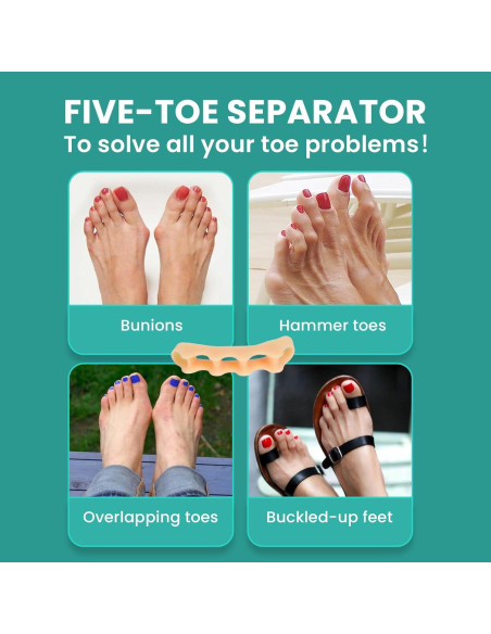 Separadores de Dedos Welnove de Silicona - Corrector de Juanetes, Paquete de 8 Separadores de Dedos Welnove de Silicona - Corrector de Juanetes, Paquete de 8