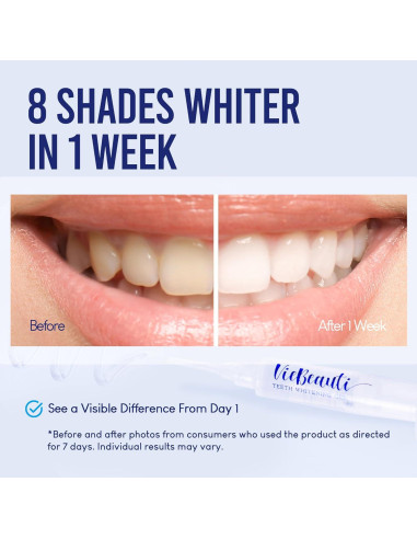 Kit Blanqueamiento Dental VieBeauti LED 35% Peróxido Menta