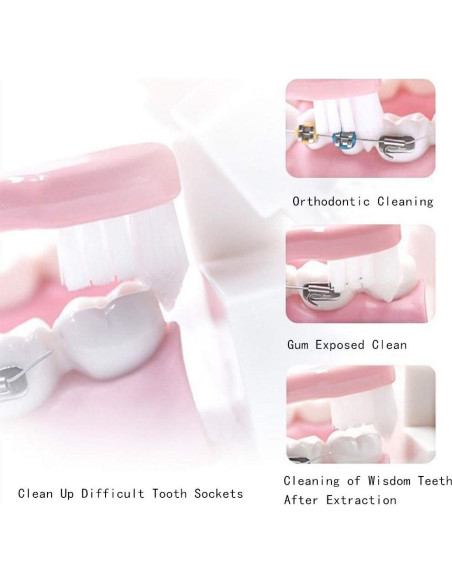 4 Cepillos de Dientes Ortodónticos Wisdom Tuft Cabeza Pequeña 4 Cepillos de Dientes Ortodónticos Wisdom Tuft Cabeza Pequeña