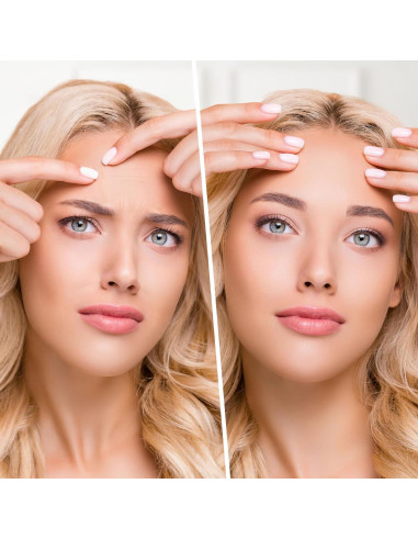 Parche Facial Antiarrugas SupreH - 14 Piezas Hidratantes