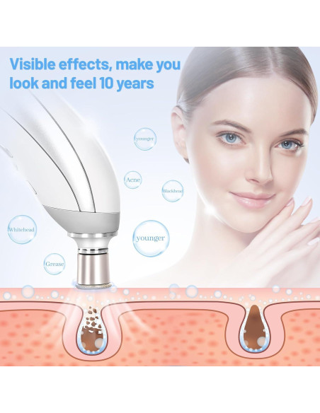 Máquina de Microdermoabrasión Profesional mcwdoit Portátil Máquina de Microdermoabrasión Profesional mcwdoit Portátil