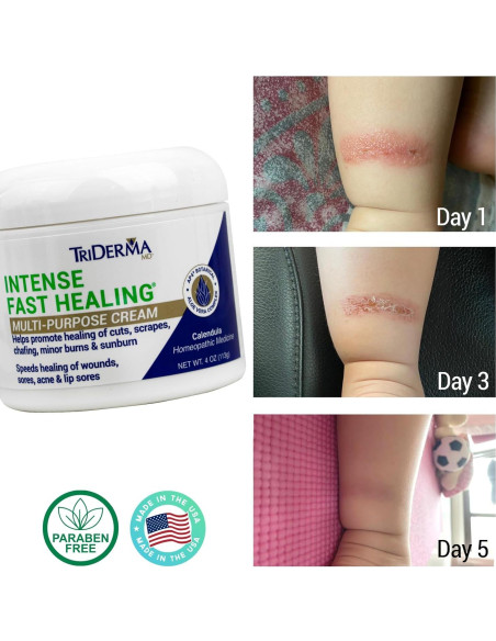 Crema Sanadora TriDerma 113g - Alivio Irritaciones Piel Crema Sanadora TriDerma 113g - Alivio Irritaciones Piel