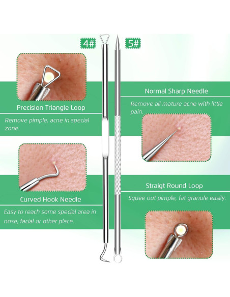Kit Extractor de Comedones 5 Piezas Kotomotoy Acero Inoxidable Kit Extractor de Comedones 5 Piezas Kotomotoy Acero Inoxidable