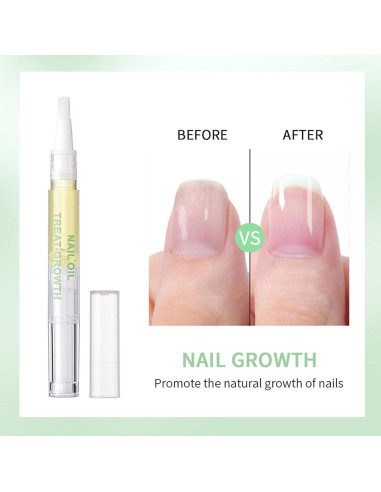 Bolígrafo Aceite para Cutículas SWETIYOU 2PCS Cuidado Uñas