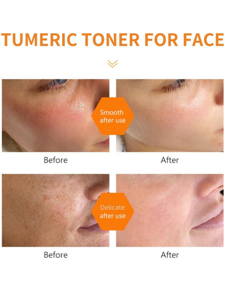 Tónico Facial de Cúrcuma Evolvique 159g - Hidratante y Anti-Envejecimiento Tónico Facial de Cúrcuma Evolvique 159g - Hidratante y Anti-Envejecimiento