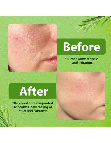 Limpiador Facial Suave Derma-nu 226.8g para Piel Sensible