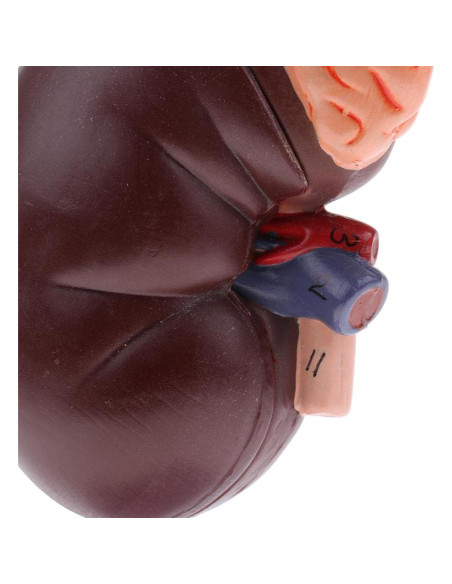 Modelo de Anatomía del Riñón Agatige, Tamaño Real, Dividido en 2 Partes Modelo de Anatomía del Riñón Agatige, Tamaño Real, Dividido en 2 Partes
