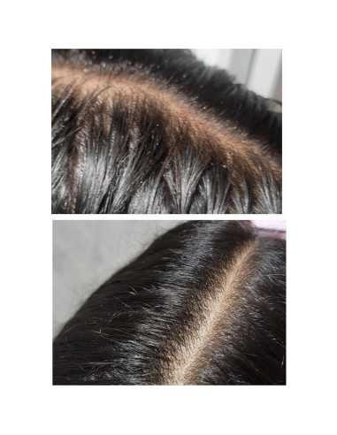 Sérum Crecimiento Cabello TRESSCURE 47.6ml - Anti-Pérdida DHT