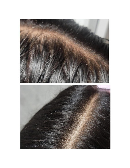 Sérum Crecimiento Cabello TRESSCURE 47.6ml - Anti-Pérdida DHT Sérum Crecimiento Cabello TRESSCURE 47.6ml - Anti-Pérdida DHT