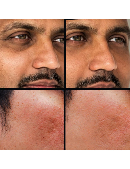 Corrector de Ojeras KODE Mens Tono 3 - 4.25g, Multiuso Corrector de Ojeras KODE Mens Tono 3 - 4.25g, Multiuso