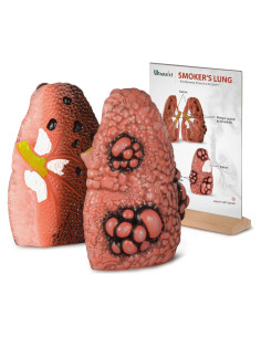 Modelo de Pulmón Cough Up Ultrassist para Educación sobre Tabaquismo