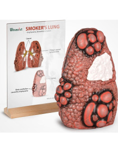 Modelo de Pulmón Cough Up Ultrassist para Educación sobre Tabaquismo 2