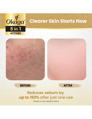 Ampoule Exfoliante de Arroz Okaga 90 mL - Piel Suave y Brillante