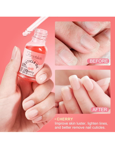 Aceite para Cutículas Foriotalas 15ml Jojoba Cereza Hidratante