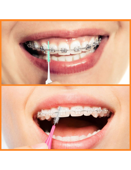 Zopeal 250 Piezas Cepillos Interdentales y Hilo Dental Zopeal 250 Piezas Cepillos Interdentales y Hilo Dental