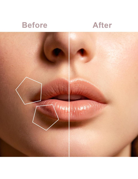 Removedor de Vello Facial Tuokiy Portátil USB Indoloro Removedor de Vello Facial Tuokiy Portátil USB Indoloro