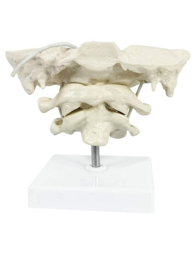Modelo Anatómico de Hueso Occipital HEMIPLEGIA 1.5X PVC