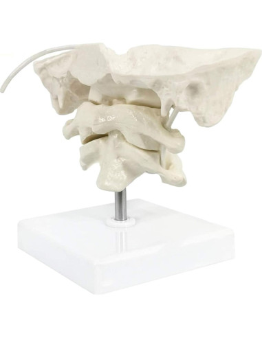 Modelo Anatómico de Hueso Occipital HEMIPLEGIA 1.5X PVC