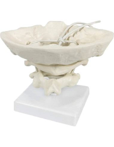 Modelo Anatómico de Hueso Occipital HEMIPLEGIA 1.5X PVC