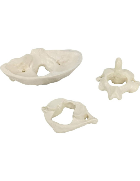 Modelo Anatómico de Hueso Occipital HEMIPLEGIA 1.5X PVC Modelo Anatómico de Hueso Occipital HEMIPLEGIA 1.5X PVC