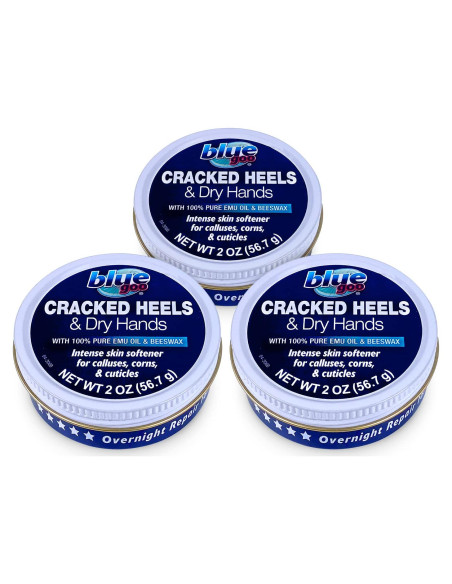 Bálsamo Hidratante Blue Goo para Talones y Manos Secas 170 g Bálsamo Hidratante Blue Goo para Talones y Manos Secas 170 g