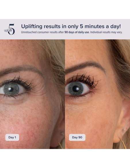 Dispositivo de Reversión de Edad upLift 5 - Tonificación Facial Dispositivo de Reversión de Edad upLift 5 - Tonificación Facial