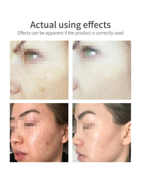 Espuma Limpiadora Facial DISAAR Belleza 100ml Vitamina E Espuma Limpiadora Facial DISAAR Belleza 100ml Vitamina E