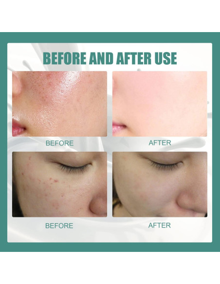 Jabón Blanqueador de Colágeno SkinFerm 60g - 2 Piezas Jabón Blanqueador de Colágeno SkinFerm 60g - 2 Piezas