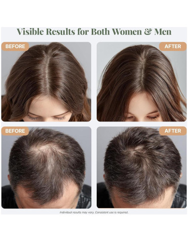 Aceite de Romero Orgánico El ÉLIX 113.4ml para Crecimiento Cabello