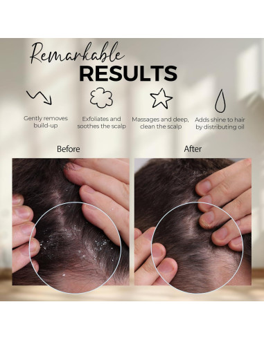 Cepillo Masajeador de Cuero Cabelludo Fiora Naturals - Exfoliador de Silicona para Caspa y Crecimiento del Cabello
