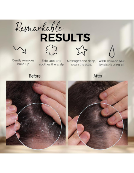 Cepillo Masajeador de Cuero Cabelludo Fiora Naturals - Exfoliador de Silicona para Caspa y Crecimiento del Cabello Cepillo Masajeador de Cuero Cabelludo Fiora Naturals - Exfoliador de Silicona para Caspa y Crecimiento del Cabello