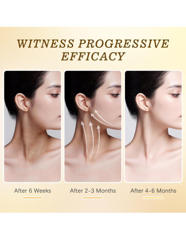 Crema Hidratante Antienvejecimiento para Cuello ANTIVP 108g