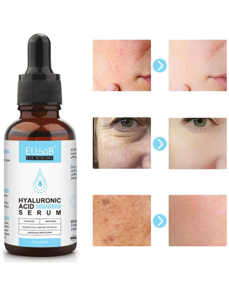 Suero Facial Anti Envejecimiento ELBBUB 30ml Vitamina C y Ácido Hialurónico Suero Facial Anti Envejecimiento ELBBUB 30ml Vitamina C y Ácido Hialurónico