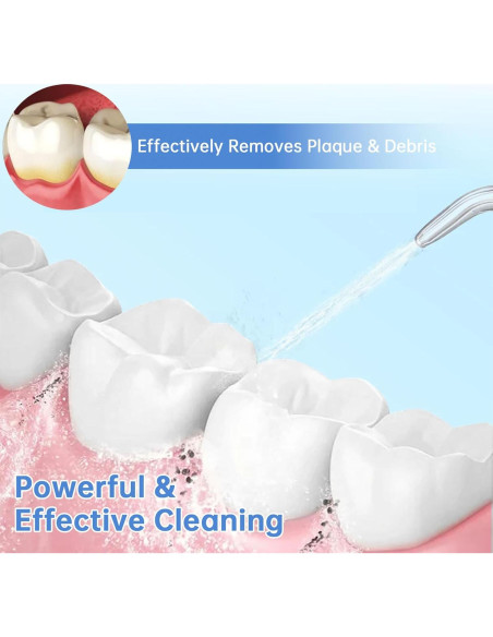 Paquete de 3 Puntas de Reemplazo para Irrigador Bucal BURST Paquete de 3 Puntas de Reemplazo para Irrigador Bucal BURST