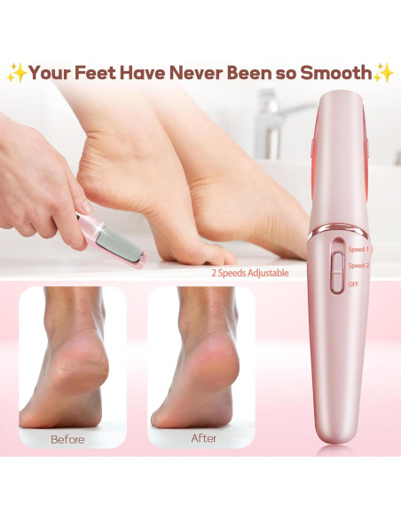 Removedor de Callos Eléctrico ZABOUL Varita de Pedicura Rosa Removedor de Callos Eléctrico ZABOUL Varita de Pedicura Rosa