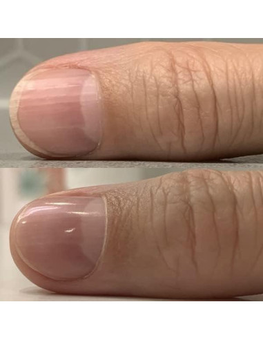 Lima de Uñas Eléctrica BELLASONIC 4-en-1 Recargable