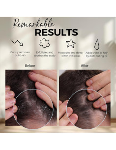 Cepillo Masajeador de Cuero Cabelludo Fiora Naturals Rosa - Exfoliador de Silicona para Caspa y Crecimiento del Cabello 2