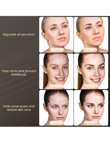 Máscara LED TIMSUMR Terapia de Luz Facial 7 Colores
