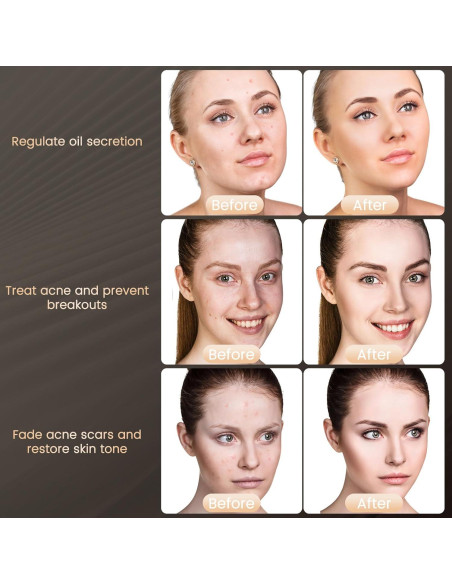 Máscara LED TIMSUMR Terapia de Luz Facial 7 Colores Máscara LED TIMSUMR Terapia de Luz Facial 7 Colores