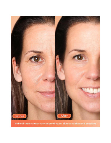 Máscara de Terapia de Luz Roja NEWKEY LED 7 Colores Facial