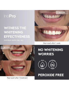 Tiras Blanqueadoras Naturales Inopro 14 Tratamientos Dientes 2
