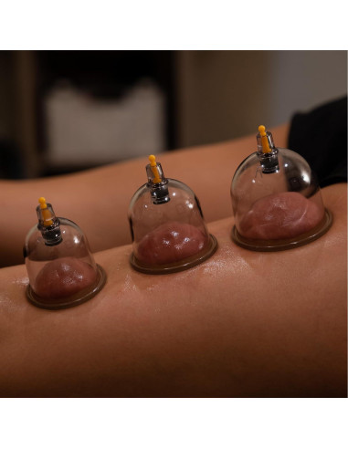 Juego de Ventosas Terapéuticas Myofascial Releaser - 18 Copas