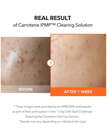 APRILSKIN Solución Limpiadora Carrotene IPMP 19.9ml - Vegana APRILSKIN Solución Limpiadora Carrotene IPMP 19.9ml - Vegana