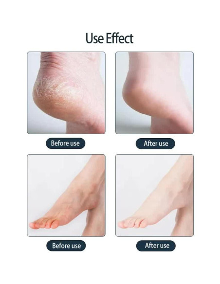 Mascarilla Hidratante para Pies Skailie - 1 Par, Hidratación Intensiva Mascarilla Hidratante para Pies Skailie - 1 Par, Hidratación Intensiva