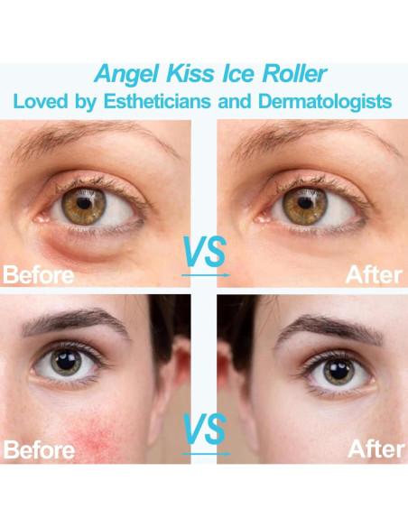 Rodillo de Hielo Angel Kiss S20 para Cara y Ojos 19x8.5cm Rodillo de Hielo Angel Kiss S20 para Cara y Ojos 19x8.5cm
