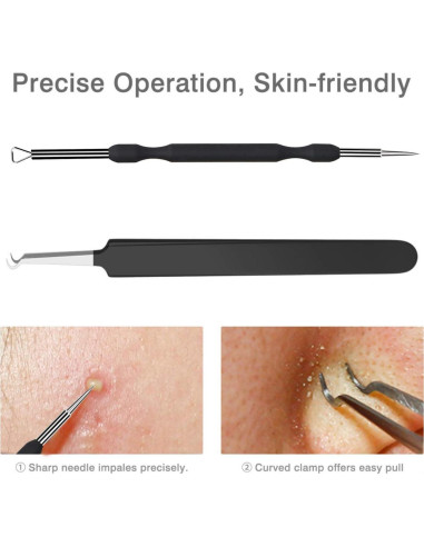 Kit de Extracción de Puntos Negros JPNK 6 Piezas Acero Inoxidable