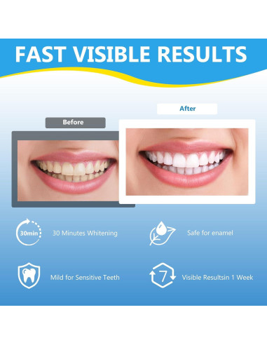 Tiras Blanqueadoras de Dientes Sensibles Milumber 42 Tiras Menta