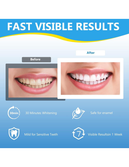 Tiras Blanqueadoras de Dientes Sensibles Milumber 42 Tiras Menta Tiras Blanqueadoras de Dientes Sensibles Milumber 42 Tiras Menta