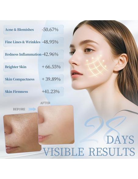 Máscara de Terapia de Luz Roja Lovsheme - Rejuvenecimiento Facial Máscara de Terapia de Luz Roja Lovsheme - Rejuvenecimiento Facial
